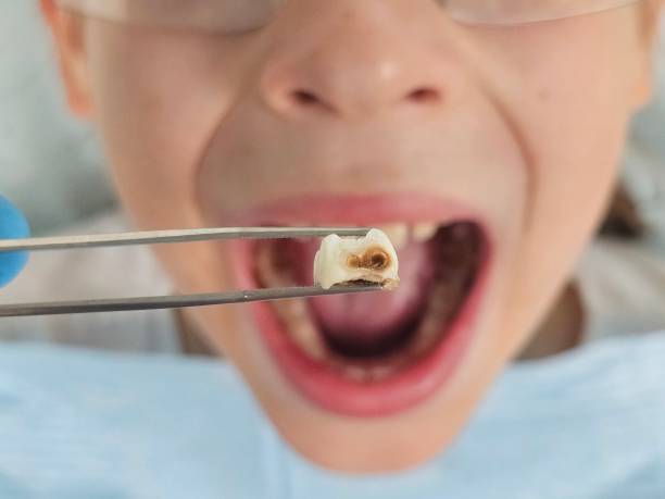 Best Pediatric Emergency Dentist in Osawatomie, KS